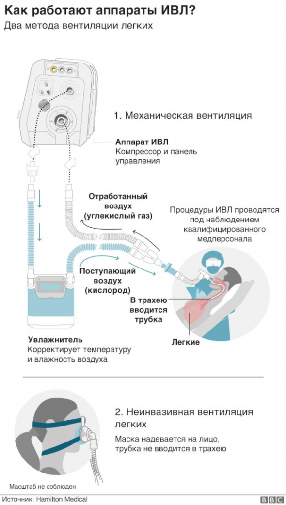 Зачем закупают аппараты ИВЛ?