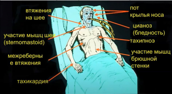 Почему все пишут про Беларусь в ключе "Слабоумие и отвага"?