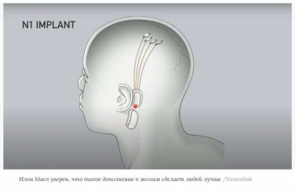 Илон Маск готов чипировать людей уже в 2020 году