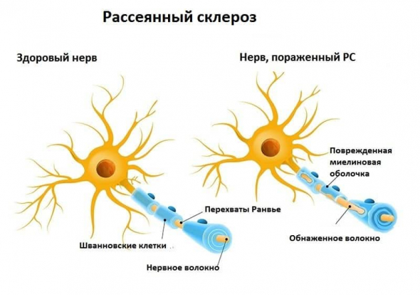 Всем известно, что отечественная вакцина от коронавируса барахло