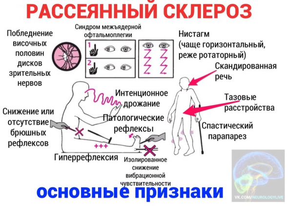 Всем известно, что отечественная вакцина от коронавируса барахло