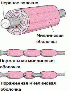 Вакцина Pfizer сделала человека инвалидом